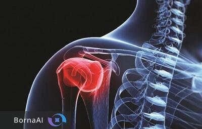  سلاحی جدید برای نابودی سرطان استخوان کشف شد!