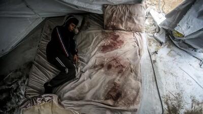  تصاویر؛ شوکه شدن داماد فلسطینی پس از فروپاشی یک زندگی کوتاه