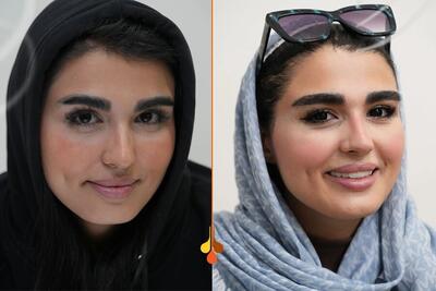  هرآنچه باید درباره کاشت ابرو به روش NTF بدانید: طراحی، عمق کاشت، نقاهت و نتیجه