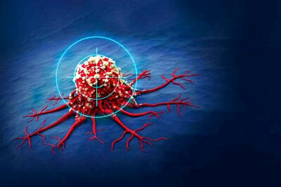 آهن‌ربا به کمک درمان سرطان آمد