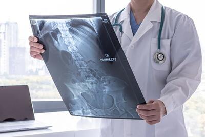  نانومواد مغناطیسی و امید تازه برای درمان سرطان استخوان