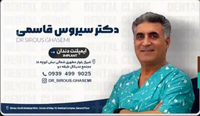  عمر مفید ایمپلنت دیجیتال چقدر است؟