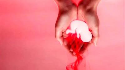 چرا سقط جنین اتفاق می افتد؟ بررسی دلایل مهم