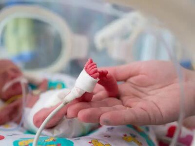 پیچیده‌ترین بیماران نورولوژیک کودکان در PICU بیمارستان قائم (عج) مشهد پذیرش و درمان می شوند