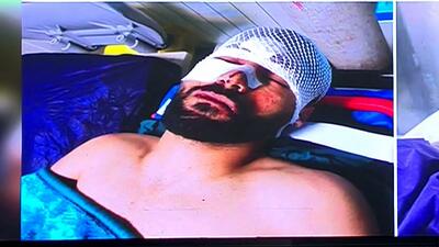  روایت سامان فلاح از نجات مجزه آسا از تصادف