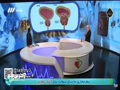 عوارض و مشکلات ناشی از بزرگی پروستات