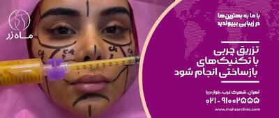  تزریق چربی را انجام ندهید!