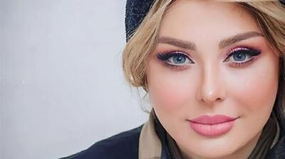 عکس جدید نیوشا ضیغمی بعد از عمل دوباره بینی!