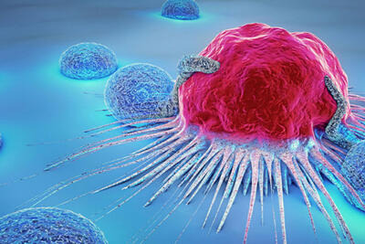 راه جلوگیری از  رشد سرطان روده کشف شد