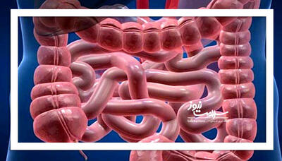 سلامت روده را با این نکات تضمین کنید