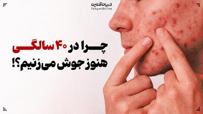 آکنه بزرگسالی | چرا در ۴۰ سالگی هنوز جوش می‌زنیم!؟