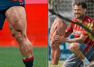 عضلانی‌ترین پای دنیا: پای مصنوعی یا هوش مصنوعی!