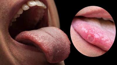  این علامت را روی زبان خود دیدید، نگران شوید!