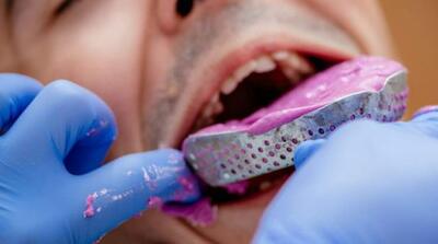 تفاوت ست قالبگیری ای سیلیکون و سی سیلیکون چیست؟ - مردم سالاری آنلاین