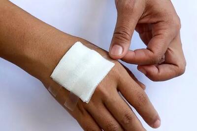 ساخت اسفنجی جدید در ایران که خونریزی رابه سرعت بند می‌آورد