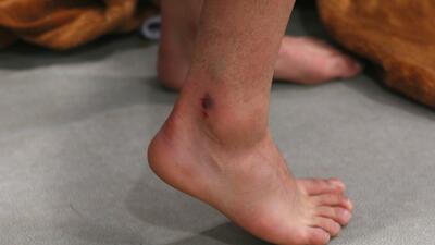 مطهری: عکس مچ پای بازیکن ما گویای همه چیز است