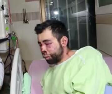  فیلم | گفت‌وگو با شماری از مجروحین حملات تروریستی اغتشاشگران در دی