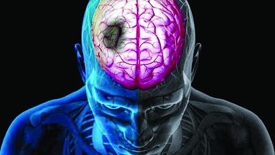 گجت پوشیدنی، صدای بیماران دچار سکته را به آنها برمی‌گرداند