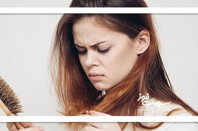  خوراکی‌هایی که ریزش مو را به دنبال دارند