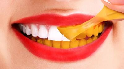  بعد از خوردن چه چیزهایی نیاز نیست مسواک بزنیم؟