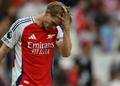 اودگارد دلیل شکست مقابل یونایتد را گفت