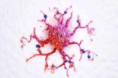 تشخیص سرطان در خانه فقط با تست ادرار!