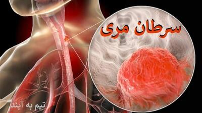 میگنا - علائم پنهان سرطان مری / خطر نوشیدن مداوم چای داغ