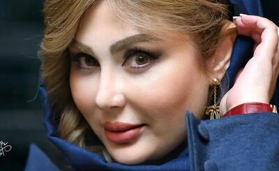  نیوشا ضیغمی در سال ۱۳۸۵؛ عکس‌هایی از قبل از جراحی‌های زیبایی - چی بپوشم