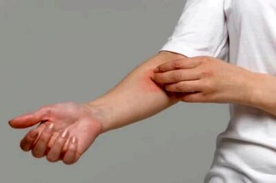  چرا بدن در شب می خارد؟ ۷ دلیل خارش شبانه + روش التیام