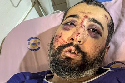 خشونت مرز نمی‌شناسد اما روایت‌ها چرا