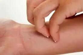 چرا برخی مواد غذایی حساسیت زا می شوند؟