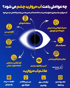اینفوتابناک | چه عواملی باعث آب مروارید می‌شود؟