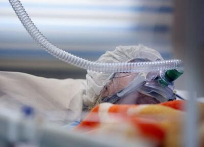 معاون وزیر بهداشت: حدود ۴۰۰ نفر از بیماران حوادث اخیر همچنان بستری و نزدیک به ۱۵۰ نفر در بخش‌های مراقبت‌های ویژه در حال درمان هستند؛ تعدادی نیز تحت عمل‌های جراحی سنگین قرار دارند