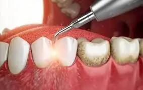 شاید باورتان نشود این مورد اصلی ترین علت دندان درد ست!