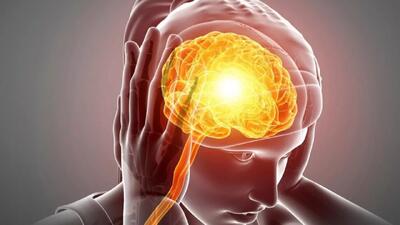  نانوداروی ایرانی مؤثر در کاهش دردهای میگرنی ثبت بین‌المللی شد