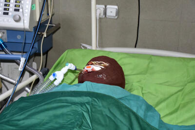 زن دیوانه که روی مرد جوان و دختر ۱۱ ساله‌اش اسید پاشی کرد