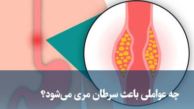  چه عواملی باعث سرطان مری می‌شود؟