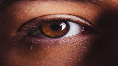 راز آب مروارید در چشم / اینفوگرافیک: چه عواملی باعث آب مروارید می‌شود؟ / راه‌های پیشگیری و درمان آب مروارید / علائم و علت‌های آب مروارید