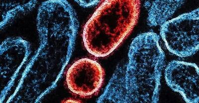 ویروس نیپا چیست؟ ۷ نکته مهم درباره این بیماری مرگبار!