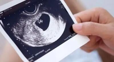 آیا سن محدودیتی برای بارداری زنان ایجاد می‌کند؟