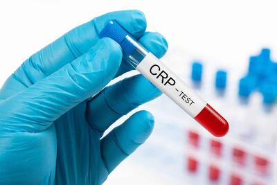  درباره آزمایش CRP برای پیش‌بینی خطر بیماری قلبی