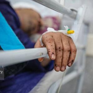 افزایش شمار مصدومان و جانباختگان انفجار بندرعباس