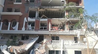  تصویری از یکی از مجروحان انفجار در بندرعباس که مورد توجه قرار گرفت