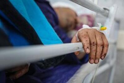  افزایش شمار مصدومان انفجار در بندرعباس به ۱۴ نفر؛ فوت یک دختر ۴ ساله