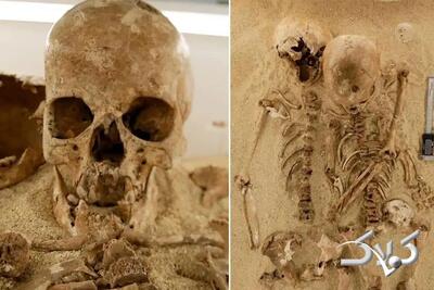  این اسکلت ۱۲ هزار ساله یک بیماری ژنتیکی نادر دارد! | عکس - مجله اینترنتی کولاک