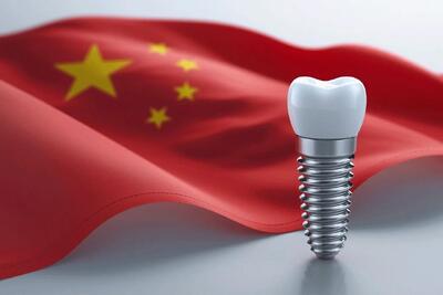 ایمپلنت دندان چینی: خطرناک یا اقتصادی؟ (بررسی برندهای چینی)
