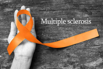 شناسایی ۱۰۰ هزار بیمار ام‌اس در کشور/ اعتبارت پژوهشی بر اساس عملکرد دستگاه‌ها باشد