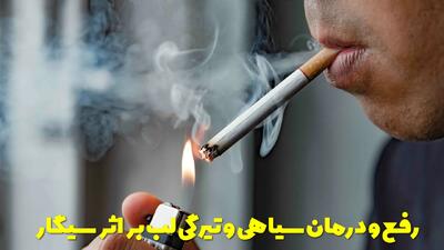  روش و راهکارهای موثر برای رفع و درمان سیاهی و تیرگی لب بر اثر سیگار