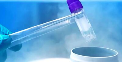  فریز جنین چیست و برای چه کسانی توصیه می‌شود؟