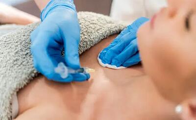  تزریق فیلر سینه، هرچه لازم است بدانید را این‌جا بخوانید!